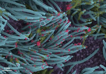 Covid-19 : les images saisissantes du SARS-CoV-2 dans nos cellules