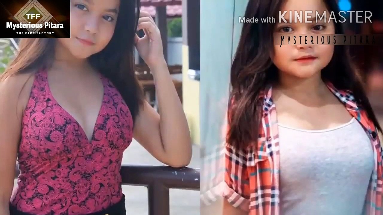 ऐसे बच्चे जो करोडोमे एक हे | most unusual kids in the world