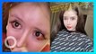 Gadis 15 tahun lakukan oplas lebih dari 100x demi dapatkan wajah boneka - TomoNews