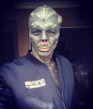 Après les oreilles, Black Alien se fait retirer le nez