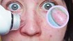We used a pore vacuum with a built-in microscope to suck out our blackheads—here's what happened