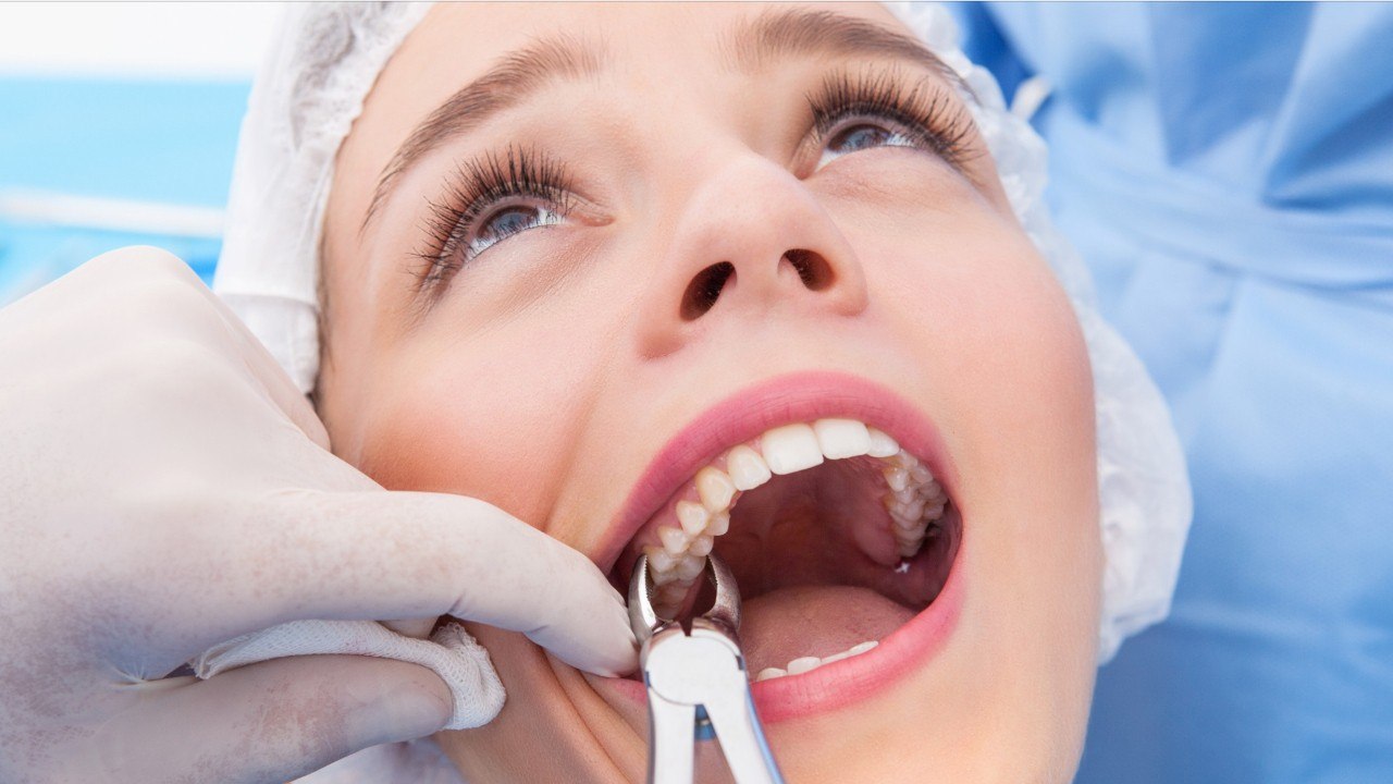 Say 'Ahhh!' Dentist Jailed For Pulling Teeth While Standing On Hoverboard