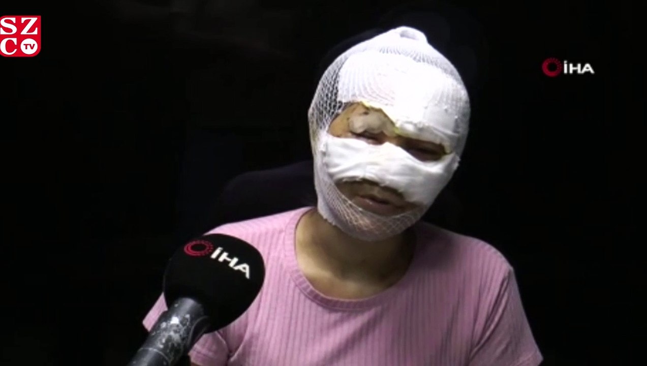 Sevgili vahşetinde gözaltı