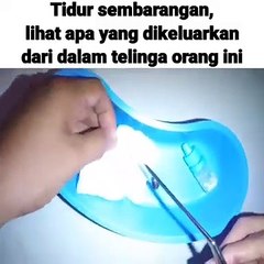 Inilah akibatnya jika tidur sembarang tempat, lihat apa yang ada didalam telinga orang ini.