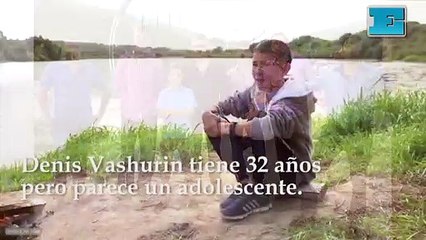 El curioso caso del hombre de 32 años que parece un niño
