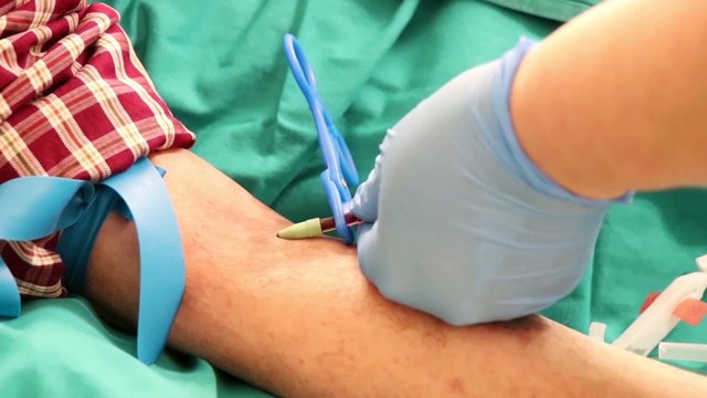 La pandemia de coronavirus sobrepasa los 950.000 muertos con 30,5 millones de casos