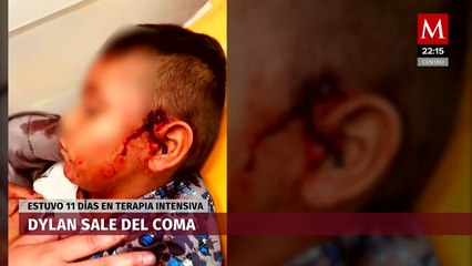 Dylan se encuentra en recuperación después de recibir una bala perdida