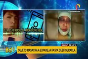 Sujeto desfigura a su pareja y luego la llama para decirle que es el amor de su vida