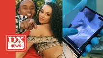 Rae Sremmurd's Slim Jxmmi Allegedly Knocked Out Pregnant Ex's Front Tooth