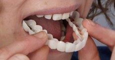 رد فعل الأطباء على تحدي الاسنان