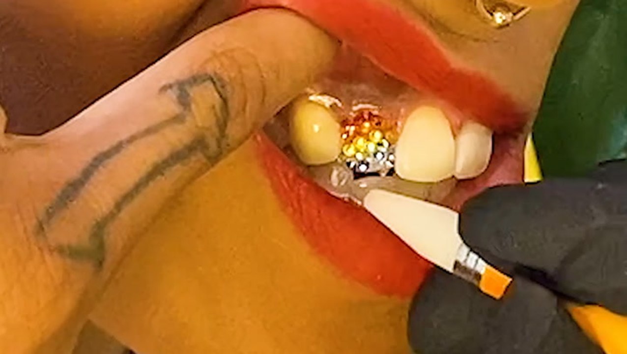 Accent your smile with Swarovski crystal tooth gems