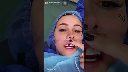 Sin un diente, Manuela Gómez mostró los estragos de un mal diseño de sonrisa