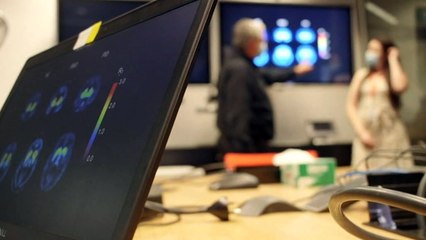 Concerns about long-term neurological impact of COVID-19