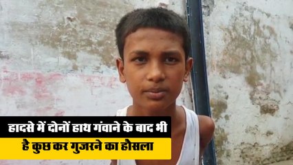 हादसे में गंवाए दोनों हाथ, फिर भी है कुछ कर गुजरने का हौसला