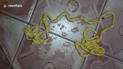 Thai man pulls 17ft long tapeworm from his bottom