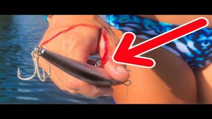 HUGE Heavy Duty Treble Hook BURIED in my Hand!