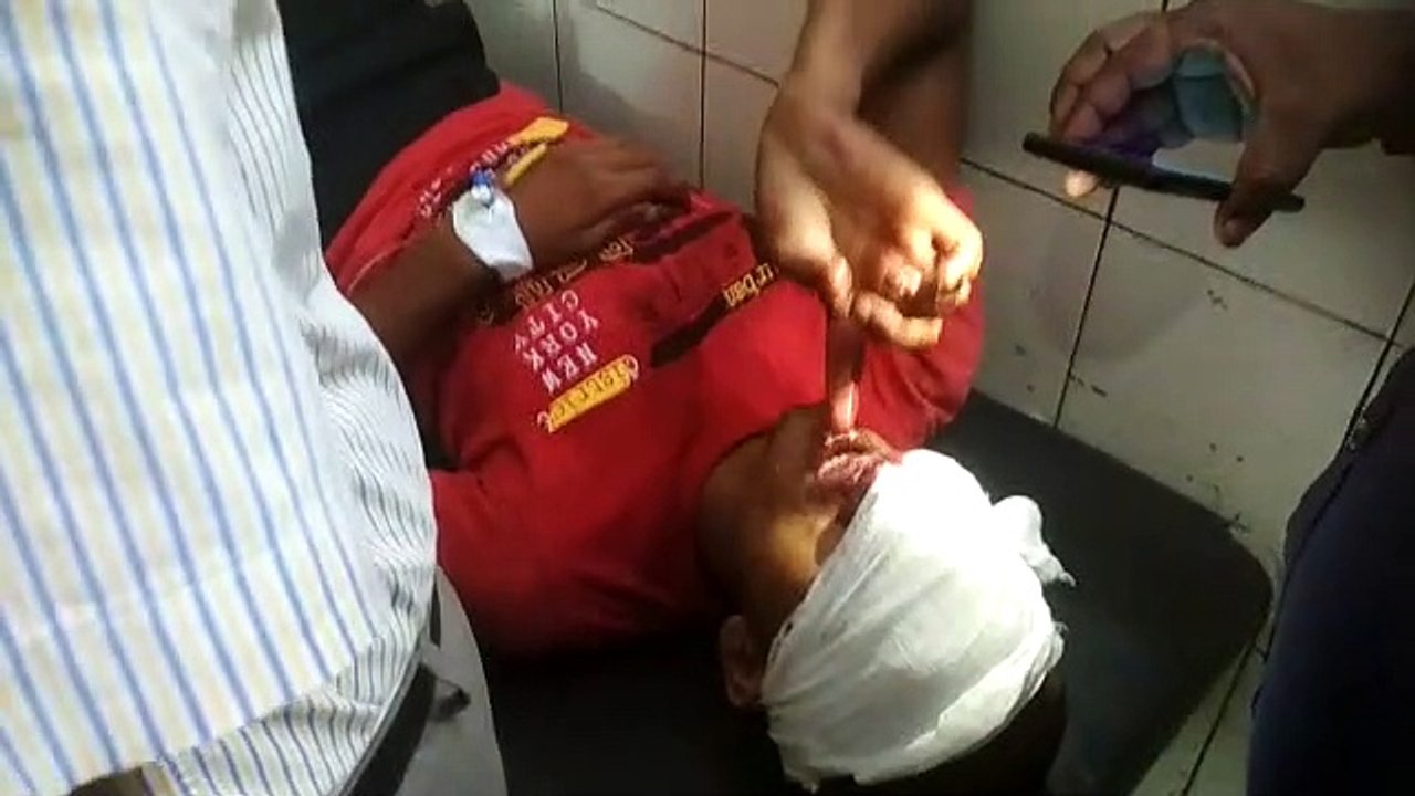 मछली मारने को लेकर चली गोली, युवक गोली लगने से घायल