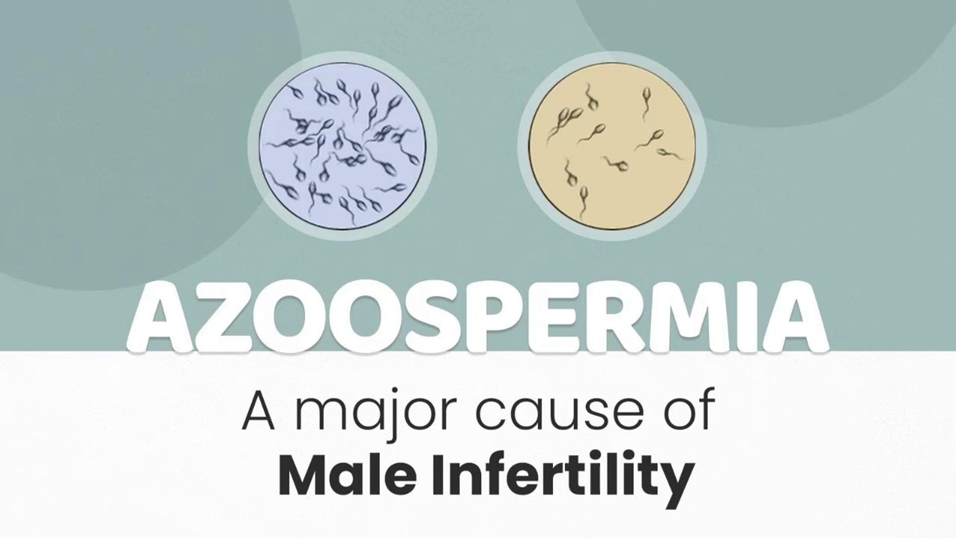 Low Sperm Count Treatment In Chennai