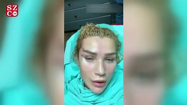 Seda Sayan estetik operasyonunu sosyal medyadan paylaştı