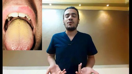 لون لسانك يدل على هذه الأمراض في الجسم