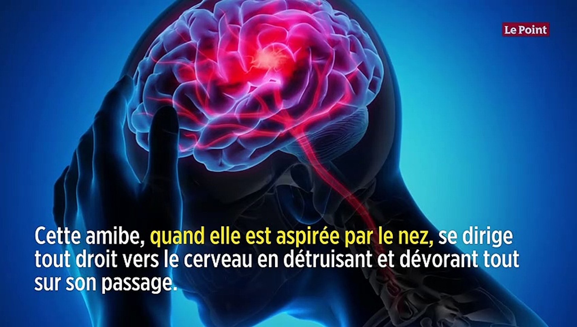 Amibe mangeuse de cerveau