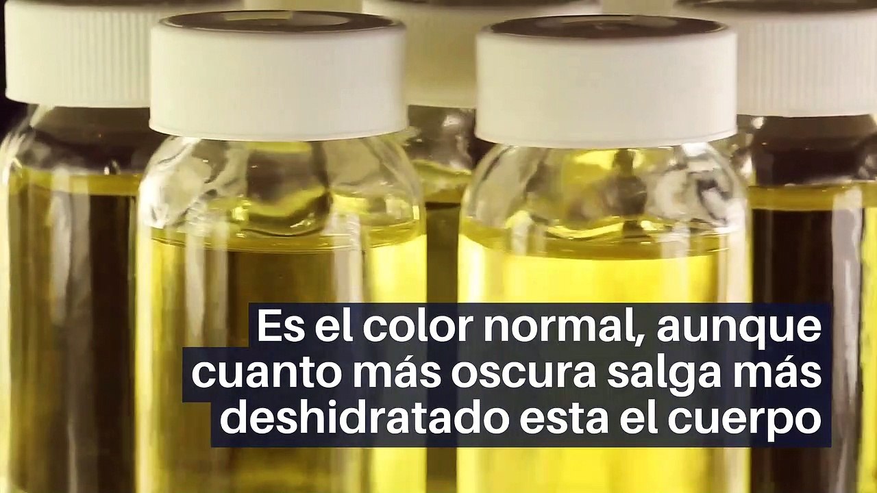 ¿Qué significan los distintos colores de la orina?