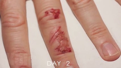 Timelapse Of A Wound Healing