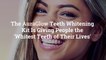 The AuraGlow Teeth Whitening Kit Is Giving People the ‘Whitest Teeth of Their Lives’