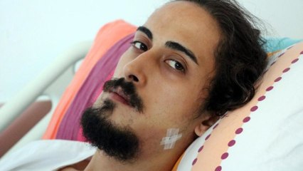 Sahilde gitar çalan tıp öğrencisinin çenesini kırdılar