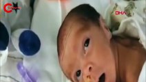 ABD'de koronavirüs taşıyan kadın entübe sırasında doğum yaptı