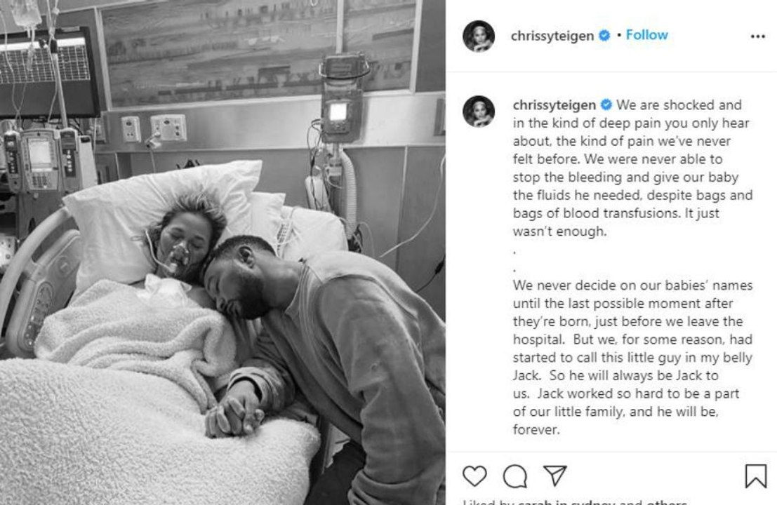 Chrissy Teigen erleidet Fehlgeburt