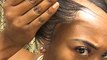 Glueless hair pieces for those experiencing hair loss
