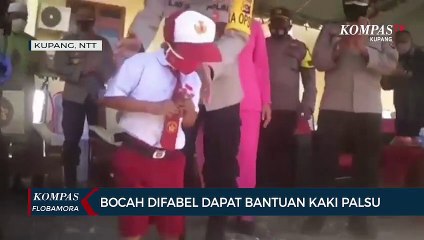 Bocah Difabel Dapat Bantuan Kaki Palsu Dari Kapolda NTT