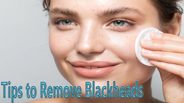 Tips to Remove Blackheads | Health Tips
