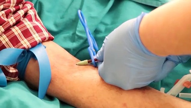 Ocho meses de pandemia, 35 millones de contagiados