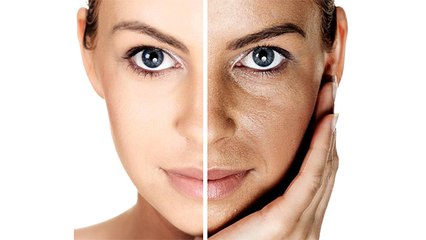 चेहरे की झाइयां हटाने के लिए इन घरेलू उपायों को करें ट्राय, जल्द दिखेगा असर । Boldsky