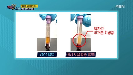 삼겹살 vs 흰쌀밥! 나쁜 콜레스테롤에 더 치명적인 식품은?