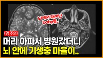 7년동안 두통에 시달리던 여자의 뇌에서 벌어지고 있었던 충격적인 진실