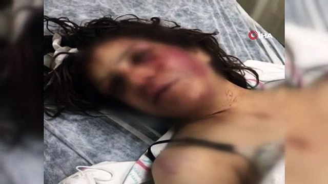 Suriye'de savaştan kaçtı; imam nikâhlı kocası kerpetenle ayak tırnaklarını çekti, zincirle dövdü!