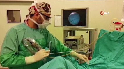 Tek böbrekli hasta, yapılan operasyonla dünya literatüründe 84’üncü vaka oldu