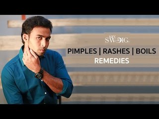 Instant remedy for Pimples,Rashes and Boils | NURTURE | Say Swag
