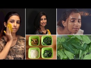 முகப்பருக்கள் மறைய வீட்டு வைத்தியம் | Pimple Treatment - Beauty Tips in Tamil