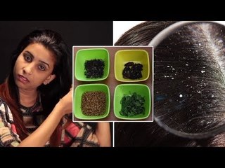தலை பொடுகு நீங்க 7 இயற்கை பொருட்கள்| Dandruff Treatment - Beauty Tips in Tamil