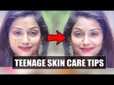 How to get rid of pimples easily! especially for teenagers