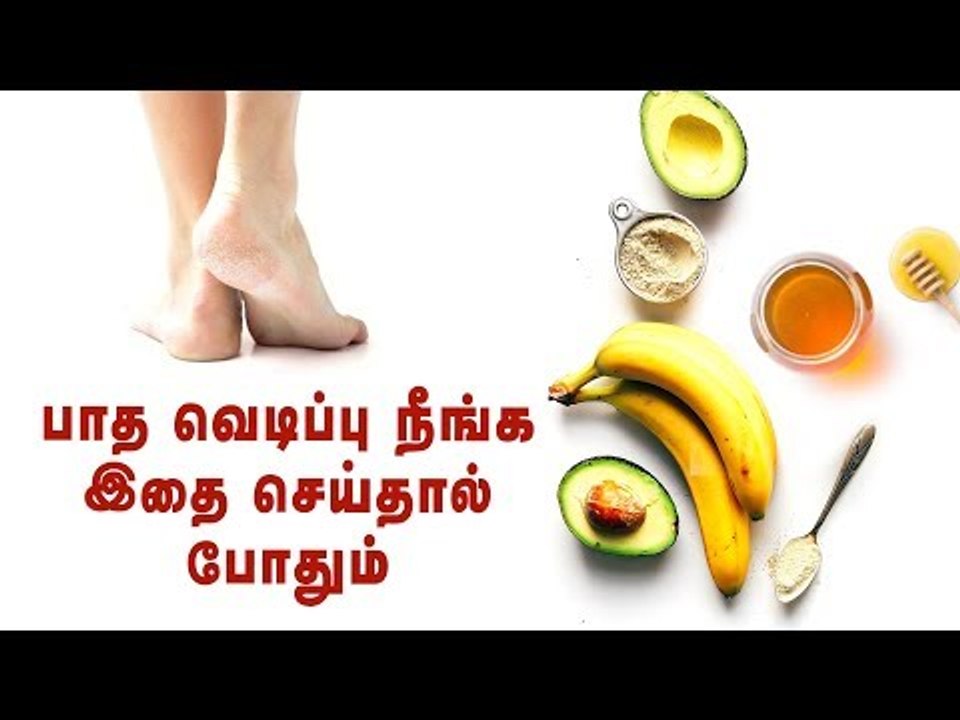 Get rid of Cracked Heels Permanently | Nature Nurture