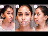 3 home remedy for Pigmentation & Brown Spots | Nature Nurture