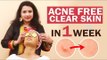 Remove Pimple&Acne in 1week | Easy Face-pack | Overnight | Pimple
