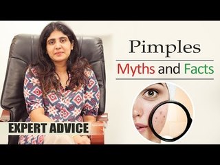 Face Wash பண்ணா Pimples போகுமா? #Pimpletips