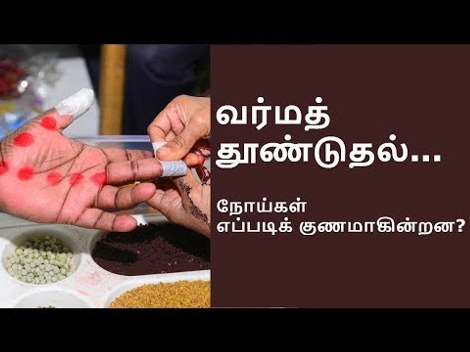 வர்மத் தூண்டுதல்... நோய்கள் குணமாவது எப்படி? - வர்மக்கலை பாண்டியராஜன்.