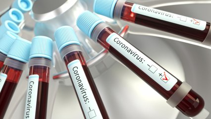 New Test Identifies Patients At Risk For Severe COVID-19